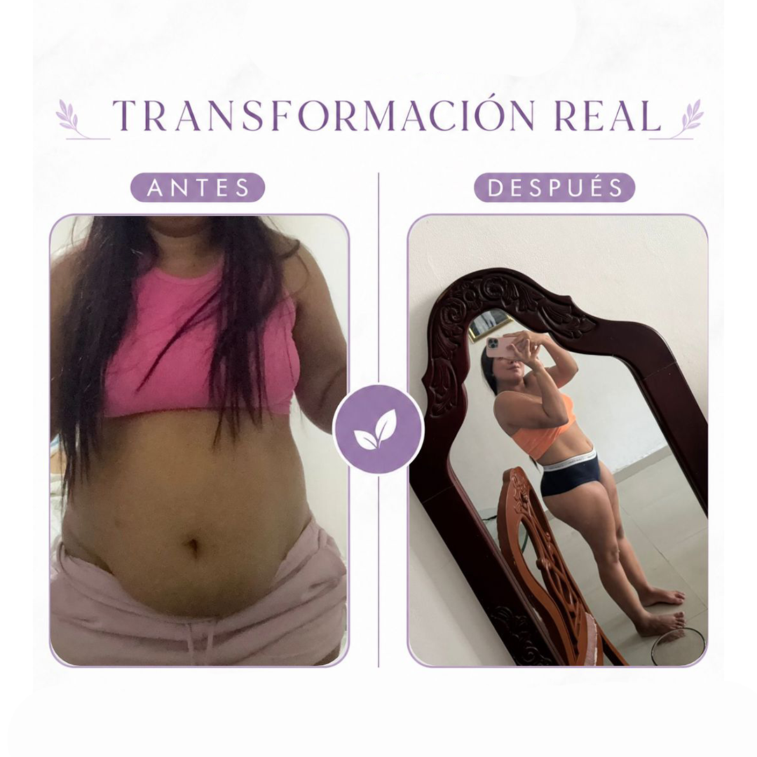 Antes y después - María López
